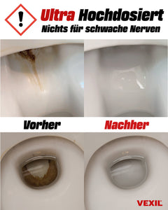 Urinsteinentferner extra Stark - entfernt hartnäckigen Urin- & Kalkstein